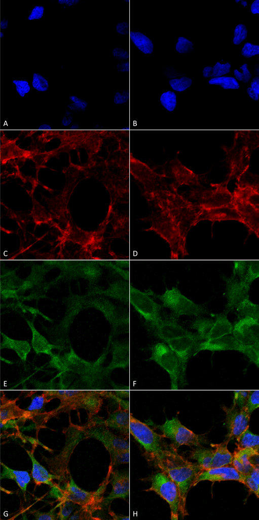 Immunocytochemistry/Immunofluorescence analysis using Mouse Anti-Acrolein Monoclonal Antibody, Clone 10A10 . Tissue: Embryonic kidney epithelial cell line (HEK293). Species: Human. Fixation: 5% Formaldehyde for 5 min. Primary Antibody: Mouse Anti-Acrolein Monoclonal Antibody at 1:50 for 30-60 min at RT. Secondary Antibody: Goat Anti-Mouse Alexa Fluor 488 at 1:1500 for 30-60 min at RT. Counterstain: Phalloidin Alexa Fluor 633 F-Actin stain; DAPI (blue) nuclear stain at 1:250, 1:50000 for 30-60 min at RT. Magnification: 20X (2X Zoom). (A,C,E,G) - Untreated. (B,D,F,H) - Cells cultured overnight with 50 µM H2O2. (A,B) DAPI (blue) nuclear stain. (C,D) Phalloidin Alexa Fluor 633 F-Actin stain. (E,F) Acrolein Antibody. (G,H) Composite. Courtesy of: Dr. Robert Burke, University of Victoria.