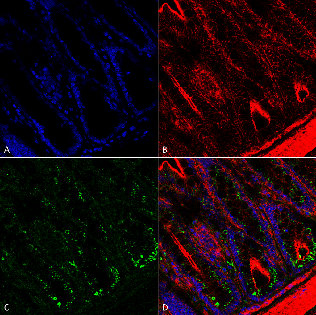 Immunohistochemistry analysis using Mouse Anti-O-GalNAc Monoclonal Antibody, Clone 9B9 . Tissue: colon. Species: Mouse. Fixation: Formalin fixed, paraffin embedded. Primary Antibody: Mouse Anti-O-GalNAc Monoclonal Antibody at 1:25 for 1 hour at RT. Secondary Antibody: Goat Anti-Mouse: Alexa Fluor 488. Counterstain: Actin-binding Phalloidin-Alexa Fluor 633; DAPI (blue) nuclear stain. Magnification: 63X. (A) DAPI (blue) nuclear stain. (B) Phalloidin Alexa Fluor 633 F-Actin stain. (C) O-GalNAc Antibody (D) Composite.