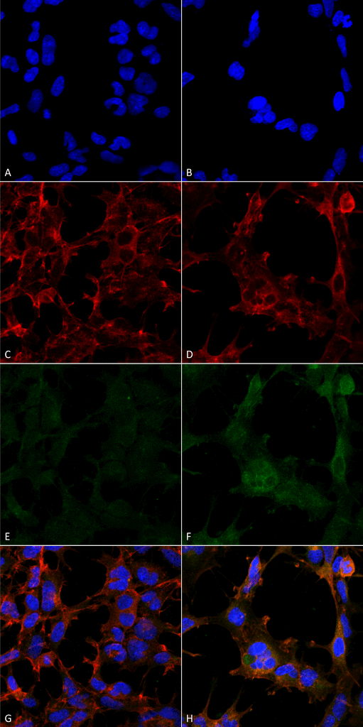 Immunocytochemistry/Immunofluorescence analysis using Mouse Anti-Hexanoyl-Lysine adduct Monoclonal Antibody, Clone 5D9 . Tissue: Embryonic kidney epithelial cell line (HEK293). Species: Human. Fixation: 5% Formaldehyde for 5 min. Primary Antibody: Mouse Anti-Hexanoyl-Lysine adduct Monoclonal Antibody at 1:50 for 30-60 min at RT. Secondary Antibody: Goat Anti-Mouse Alexa Fluor 488 at 1:1500 for 30-60 min at RT. Counterstain: Phalloidin Alexa Fluor 633 F-Actin stain; DAPI (blue) nuclear stain at 1:250, 1:50000 for 30-60 min at RT. Magnification: 20X (2X Zoom). (A,C,E,G) - Untreated. (B,D,F,H) - Cells cultured overnight with 50 µM H2O2. (A,B) DAPI (blue) nuclear stain. (C,D) Phalloidin Alexa Fluor 633 F-Actin stain. (E,F) Hexanoyl-Lysine adduct Antibody. (G,H) Composite. Courtesy of: Dr. Robert Burke, University of Victoria.