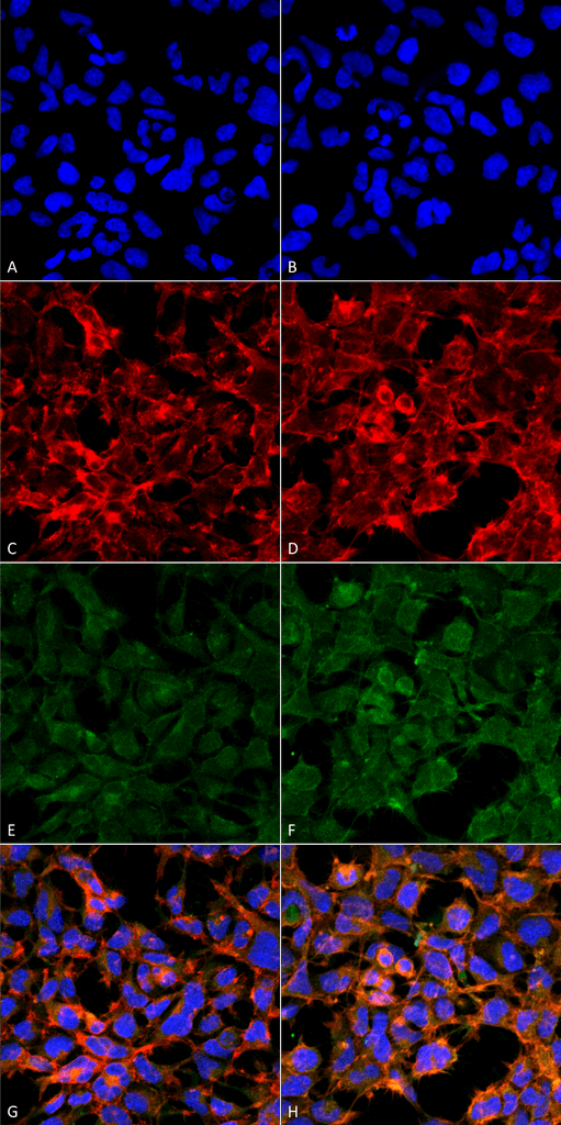 Immunocytochemistry/Immunofluorescence analysis using Mouse Anti-Malondialdehyde Monoclonal Antibody, Clone 11E3 . Tissue: Embryonic kidney epithelial cell line (HEK293). Species: Human. Fixation: 5% Formaldehyde for 5 min. Primary Antibody: Mouse Anti-Malondialdehyde Monoclonal Antibody at 1:50 for 30-60 min at RT. Secondary Antibody: Goat Anti-Mouse Alexa Fluor 488 at 1:1500 for 30-60 min at RT. Counterstain: Phalloidin Alexa Fluor 633 F-Actin stain; DAPI (blue) nuclear stain at 1:250, 1:50000 for 30-60 min at RT. Magnification: 20X (2X Zoom). (A,C,E,G) - Untreated. (B,D,F,H) - Cells cultured overnight with 50 µM H2O2. (A,B) DAPI (blue) nuclear stain. (C,D) Phalloidin Alexa Fluor 633 F-Actin stain. (E,F) Malondialdehyde Antibody. (G,H) Composite. Courtesy of: Dr. Robert Burke, University of Victoria.