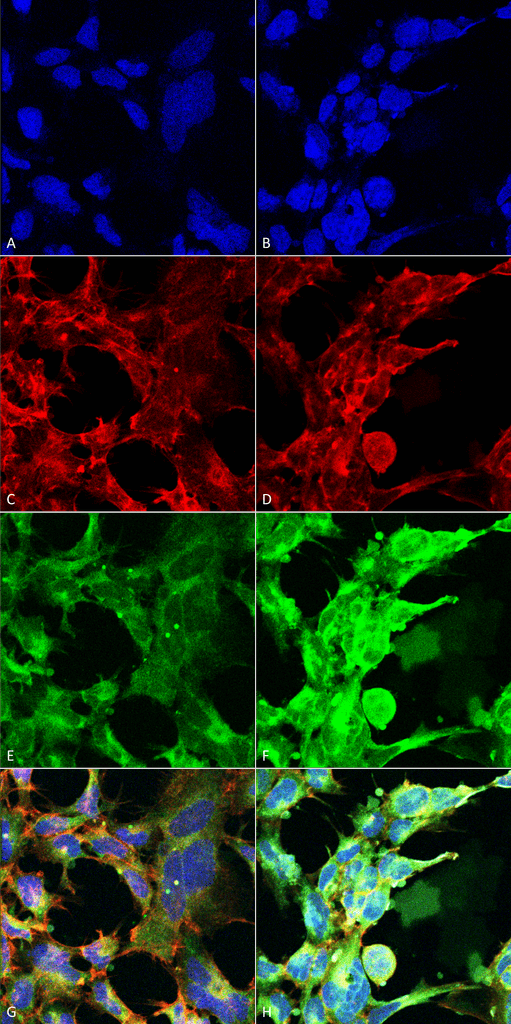 Immunocytochemistry/Immunofluorescence analysis using Mouse Anti-Methylglyoxal Monoclonal Antibody, Clone 9F11 . Tissue: Embryonic kidney epithelial cell line (HEK293). Species: Human. Fixation: 5% Formaldehyde for 5 min. Primary Antibody: Mouse Anti-Methylglyoxal Monoclonal Antibody at 1:50 for 30-60 min at RT. Secondary Antibody: Goat Anti-Mouse Alexa Fluor 488 at 1:1500 for 30-60 min at RT. Counterstain: Phalloidin Alexa Fluor 633 F-Actin stain; DAPI (blue) nuclear stain at 1:250, 1:50000 for 30-60 min at RT. Magnification: 20X (2X Zoom). (A,C,E,G) - Untreated. (B,D,F,H) - Cells cultured overnight with 50 µM H2O2. (A,B) DAPI (blue) nuclear stain. (C,D) Phalloidin Alexa Fluor 633 F-Actin stain. (E,F) Methylglyoxal Antibody. (G,H) Composite. Courtesy of: Dr. Robert Burke, University of Victoria.