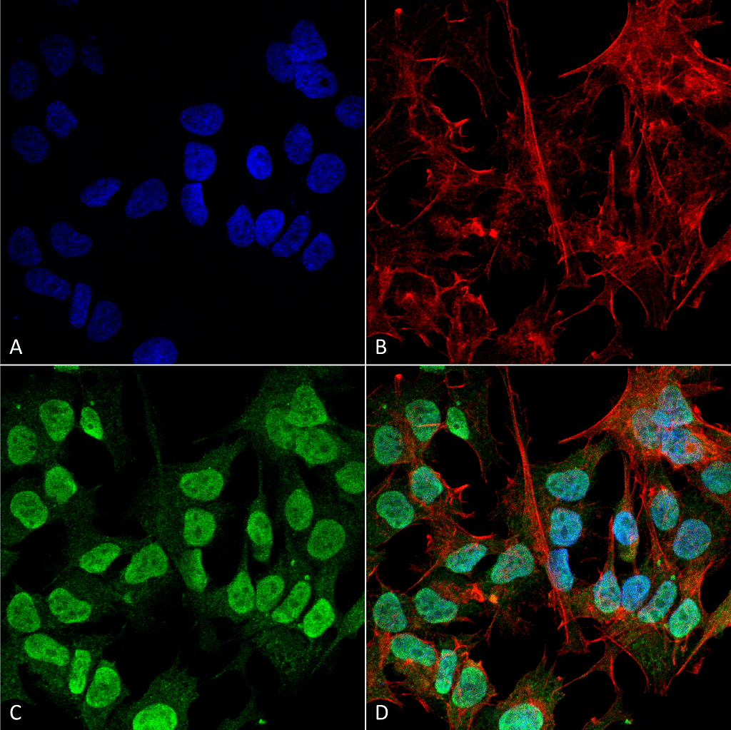 Immunocytochemistry/Immunofluorescence analysis using Mouse Anti-Alpha Synuclein Monoclonal Antibody, Clone 3F8 . Tissue: Neuroblastoma cell line (SK-N-BE). Species: Human. Fixation: 4% Formaldehyde for 15 min at RT. Primary Antibody: Mouse Anti-Alpha Synuclein Monoclonal Antibody at 1:100 for 60 min at RT. Secondary Antibody: Goat Anti-Mouse ATTO 488 at 1:200 for 60 min at RT. Counterstain: Phalloidin Texas Red F-Actin stain; DAPI (blue) nuclear stain at 1:1000, 1:5000 for 60 min at RT, 5 min at RT. Localization: Cytoplasm: weak; Nucleus: Med. Magnification: 60X. (A) DAPI (blue) nuclear stain. (B) Phalloidin Texas Red F-Actin stain. (C) Alpha Synuclein Antibody. (D) Composite.