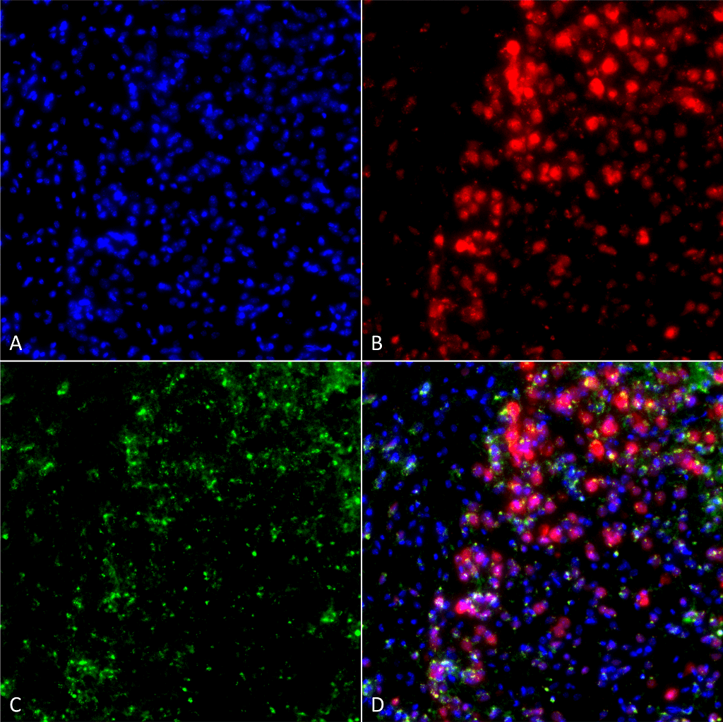 Immunocytochemistry/Immunofluorescence analysis using Mouse Anti-Alpha Synuclein Monoclonal Antibody, Clone 3F8 . Tissue: Primary hippocampal neurons treated with active Alpha Synuclein Protein Aggregate (SPR-322) at 4 µg/ml to induce fibrils. Species: Rat. Fixation: 4% paraformaldehyde. Primary Antibody: Mouse Anti-Alpha Synuclein Monoclonal Antibody at 1:200 for 24 hours at 4°C. Secondary Antibody: Goat Anti-Mouse Alexa Fluor 488 at 1:700 for 1 hour at RT. Counterstain: Guinea Pig Anti-NeuN (red) neuronal marker (Donkey Anti-Guinea Pig Alexa Fluor 647 1:700); DAPI (blue) nuclear stain at 1:6000, 1:3000 for 60 min at RT, 5 min at RT. Magnification: 20X. (A) DAPI (blue) nuclear stain. (B) NeuN neuronal marker (red). (C) Alpha Synuclein Antibody. (D) Composite.