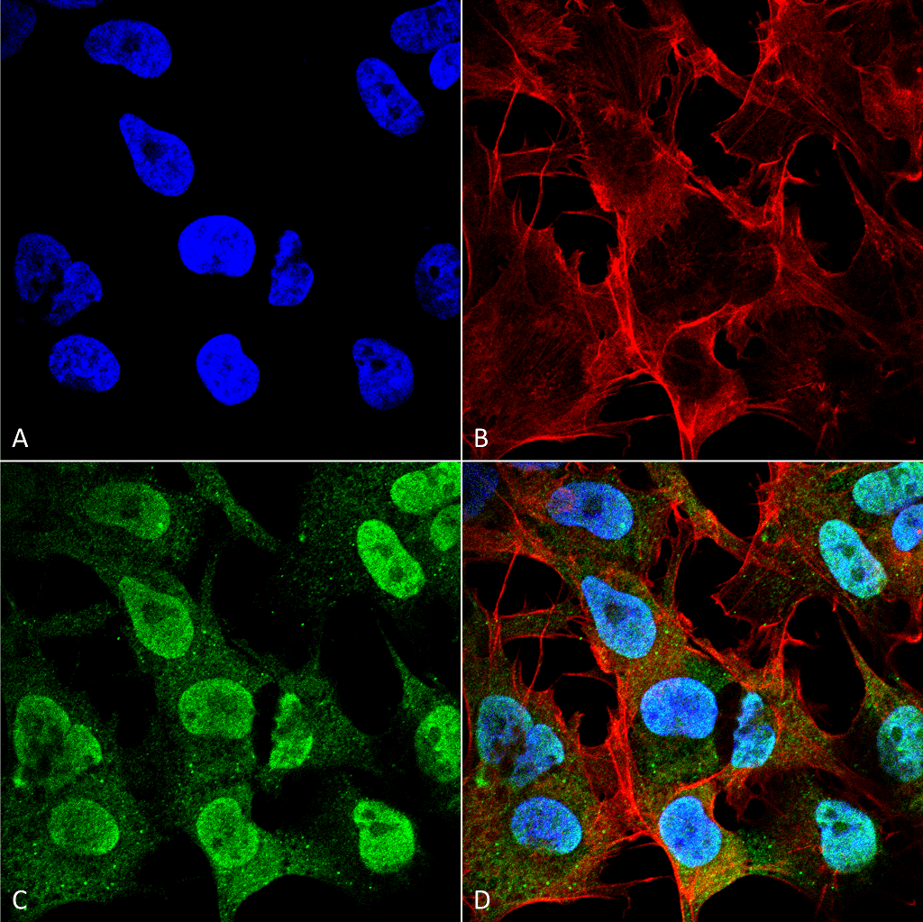 Immunocytochemistry/Immunofluorescence analysis using Mouse Anti-Alpha Synuclein Monoclonal Antibody, Clone 4F1 . Tissue: Neuroblastoma cell line (SK-N-BE). Species: Human. Fixation: 4% Formaldehyde for 15 min at RT. Primary Antibody: Mouse Anti-Alpha Synuclein Monoclonal Antibody at 1:100 for 60 min at RT. Secondary Antibody: Goat Anti-Mouse ATTO 488 at 1:200 for 60 min at RT. Counterstain: Phalloidin Texas Red F-Actin stain; DAPI (blue) nuclear stain at 1:1000, 1:5000 for 60 min at RT, 5 min at RT. Localization: Cytoplasm: medium; Nucleus: strong. Magnification: 60X. (A) DAPI (blue) nuclear stain. (B) Phalloidin Texas Red F-Actin stain. (C) Alpha Synuclein Antibody. (D) Composite.